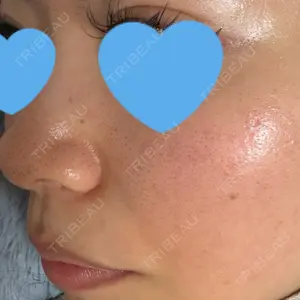 ウィルビークリニック 新宿院口コミ