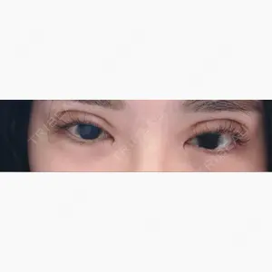 東京シンデレラ美容外科 新宿院口コミ