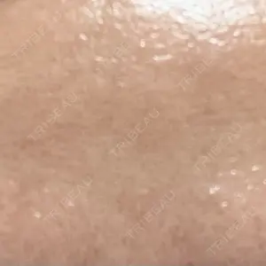 ゆきスキンクリニック 東池袋口コミ