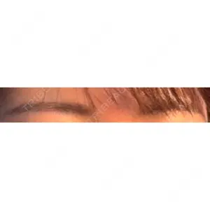 渋谷の森クリニック口コミ