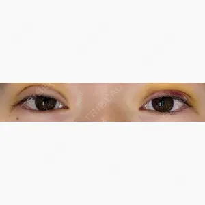 愛知春日井美容外科ネビュラクリニック口コミ