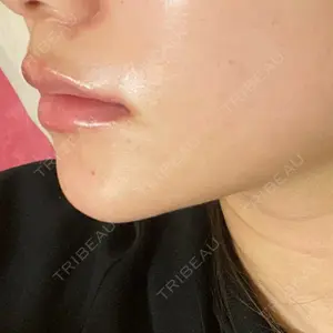 ルラ美容クリニック 名古屋栄院 / ルラスキンクリニック 名古屋栄院口コミ