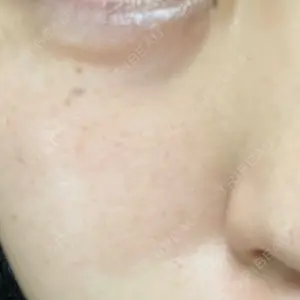 ルラ美容クリニック 静岡院口コミ