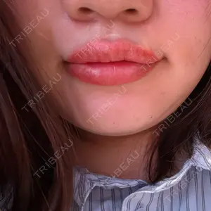 Tokyo Tensei Clinic 新宿院口コミ