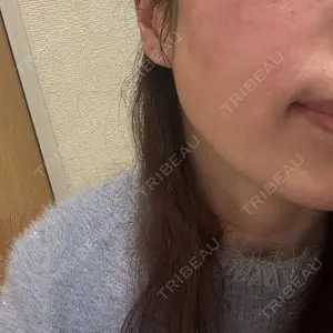 フィラークリニック 大阪心斎橋院口コミ