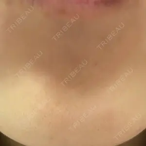 湘南美容クリニック 金山院口コミ