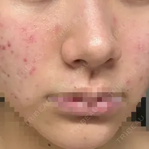 ルラ美容クリニック 仙台院 / ルラスキンクリニック 仙台院口コミ