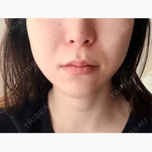 Chloe Cheongdam Clinic （クロエチョンダムクリニック）口コミ