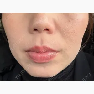 Tokyo Tensei Clinic 大阪梅田院口コミ