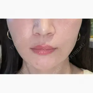 グレーススキンクリニック口コミ