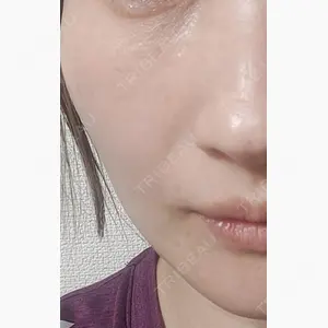 ゆきスキンクリニック 東池袋口コミ