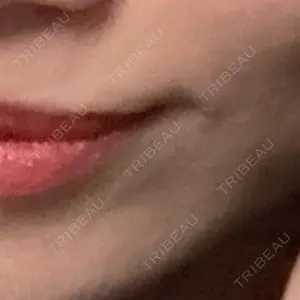 フィラークリニック 新宿院口コミ