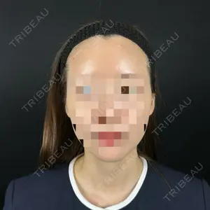 藤・ナチュレ美容クリニック 銀座院口コミ