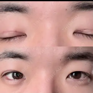 ルラ美容クリニック 札幌大通り院口コミ