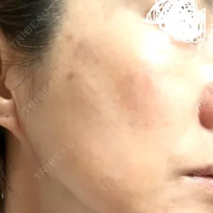 S-Laboクリニック 渋谷院口コミ