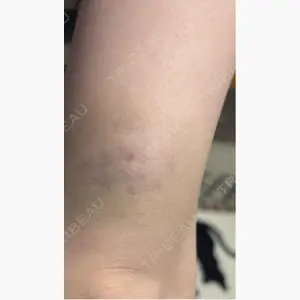 フィラークリニック 大阪心斎橋院口コミ