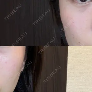 DAILY SKIN CLINIC 新宿院口コミ