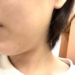 藤・ナチュレ美容クリニック 銀座院口コミ