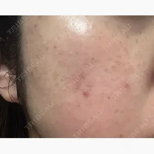 東京美容外科 名古屋院口コミ