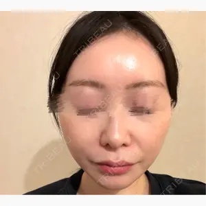 Chloe Cheongdam Clinic （クロエチョンダムクリニック）口コミ