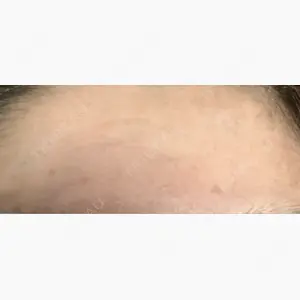 千葉美容外科アイビークリニック口コミ