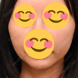 Days Beauty Clinic 新宿院口コミ