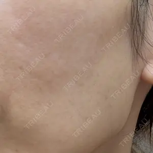 ルラ美容クリニック 札幌本院口コミ