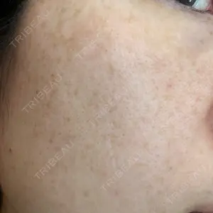 ルラ美容クリニック 千葉院 / ルラスキンクリニック 千葉院口コミ