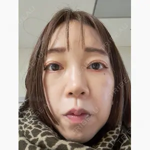 BiBiクリニック口コミ