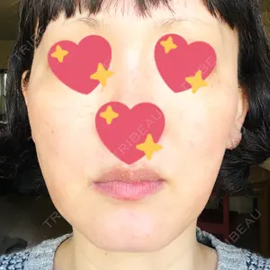 DAILY SKIN CLINIC 心斎橋院口コミ