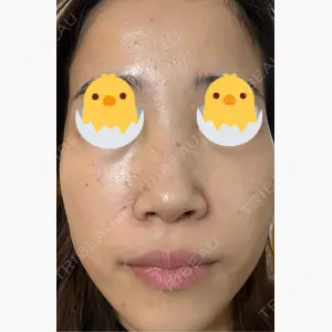 ハナビューティークリニック口コミ