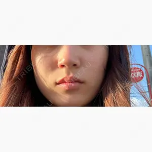 東京美容外科 福岡院口コミ