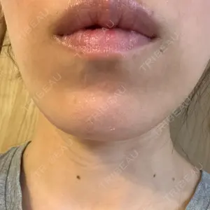 Tokyo Tensei Clinic 銀座院口コミ