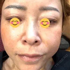 ルラ美容クリニック 郡山院口コミ