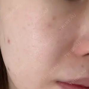 ルラ美容クリニック 郡山院口コミ