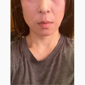 BON BON CLINIC 渋谷院口コミ