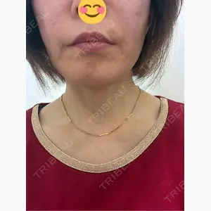 フローラクリニック口コミ