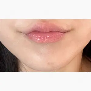 上野注入クリニック口コミ