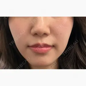 フィラークリニック 大阪心斎橋院口コミ