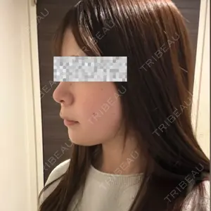 藤・ナチュレ美容クリニック 銀座院口コミ