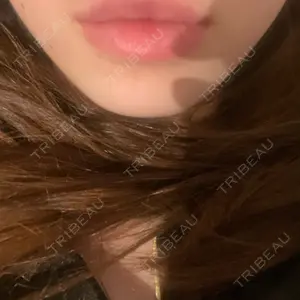 博多美容外科/美容皮膚科 ビラビューティークリニック口コミ