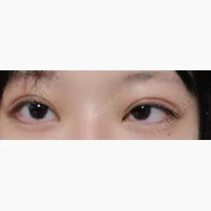 アリエル美容クリニック 横浜院口コミ