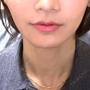 ルラ美容クリニック 横浜院口コミ