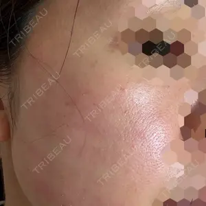 Chloe Cheongdam Clinic （クロエチョンダムクリニック）口コミ