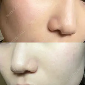 ルラ美容クリニック 町田院口コミ