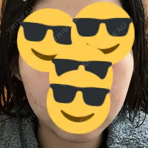 ルラ美容クリニック 大阪心斎橋院口コミ