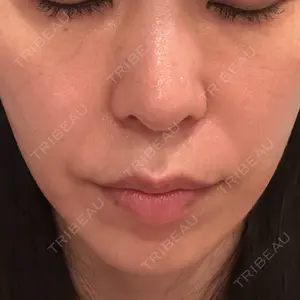 APスキンクリニック銀座口コミ