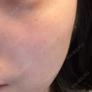 ライズワン美容皮膚科クリニック口コミ