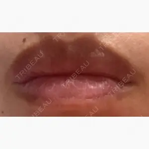 TCB東京中央美容外科 静岡院口コミ