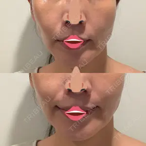 PRISM Beauty Clinic 新宿院口コミ